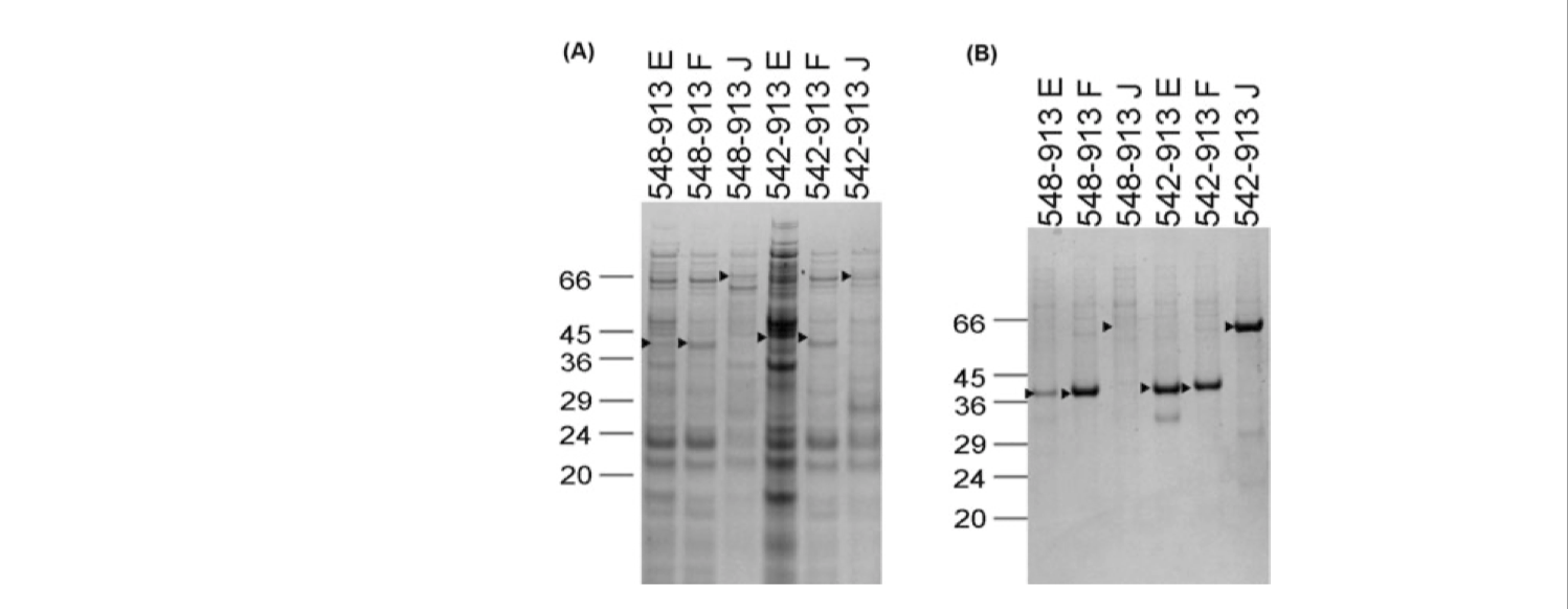 SDS-PAGE gel after NiNTA magnetic bead purification showing expression of constructs for DDR1 in (A) *E. coli* and (B) insect cells via the baculovirus system. The names of constructs correspond to amino acid start and end points and the vector being used (pOPINE, pOPINF or pOPINJ, which confers a C-terminal His-tag, an N-terminal His-tag, or an N-terminal His-GST tag, respectively)